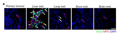 转入幼鼠模型得到一样的试验了局，且在转移产生前NET已在肝脏聚积。