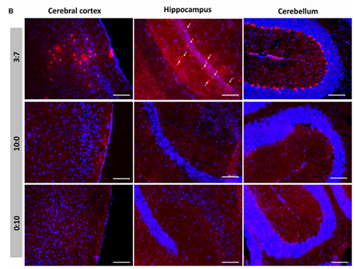 被包裹在含有NT-类脂质的LNP中的Cre沉组酶成功转移。大脑中的转染神经元呈红色高亮。
