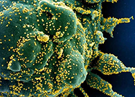 唾液检测新冠抗体新步骤来了，获取了局仅需几幼时！