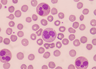 一种神秘颗粒被发现了！它能否成为败血症早筛标志物？