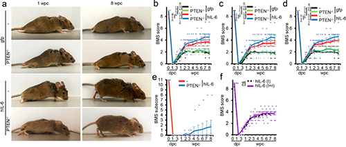 Hyper-IL-6推进职能复原(起源：Nature)