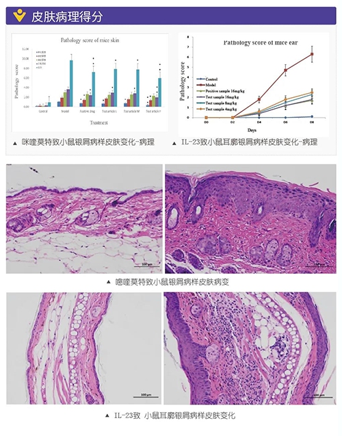 咪喹莫特致幼鼠银屑病样皮肤变动病理得分