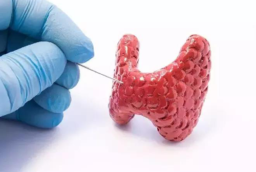 甲状腺疾病，蕴含甲状腺职能减退和甲状腺职能亢进，自古以来就是反复被医学钻研人员钻研的疾病