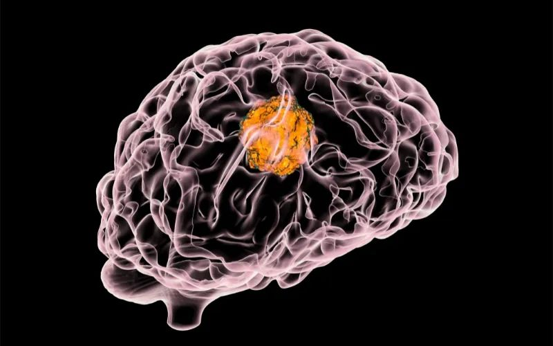 J9集团助力 | 璧辰医药ABM-1310获美国FDA孤儿药资格认证，用于医治携带BRAF V600突变的脑胶质母细胞瘤患者