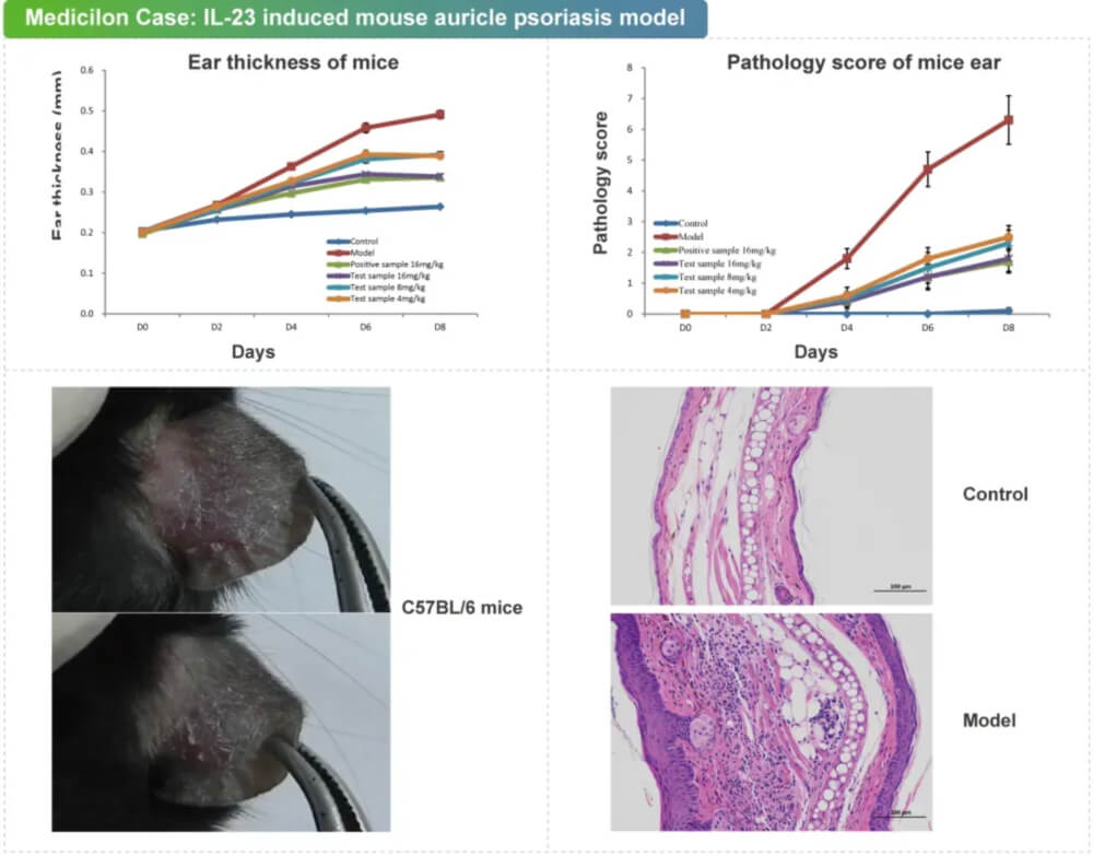 06 IL-23诱导的幼鼠耳廓银屑病模型.jpg